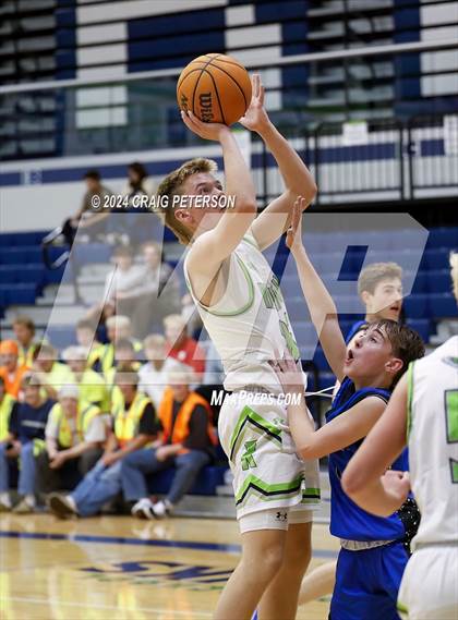 Thumbnail 3 in Fremont @ Ridgeline photogallery.