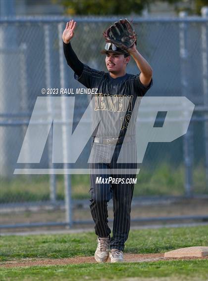 Thumbnail 1 in Kennedy vs Legacy photogallery.
