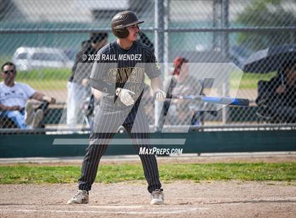 Thumbnail 1 in Kennedy vs Legacy photogallery.
