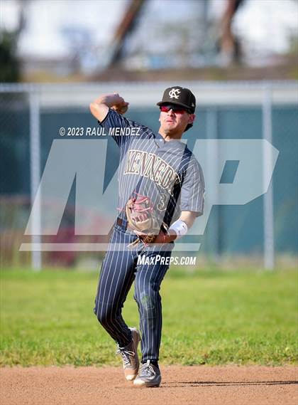 Thumbnail 3 in Kennedy vs Legacy photogallery.