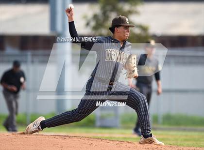 Thumbnail 3 in Kennedy vs Legacy photogallery.