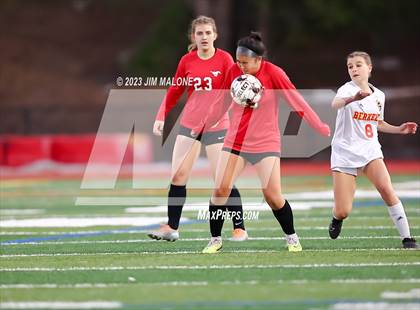 Thumbnail 1 in JV: Berkeley @ Monte Vista photogallery.