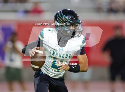 Thumbnail 3 in Buchanan vs Kennedy photogallery.