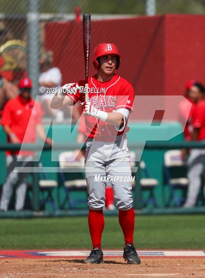 Thumbnail 1 in Hoover vs. Buchanan photogallery.