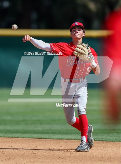 Thumbnail 3 in Hoover vs. Buchanan photogallery.