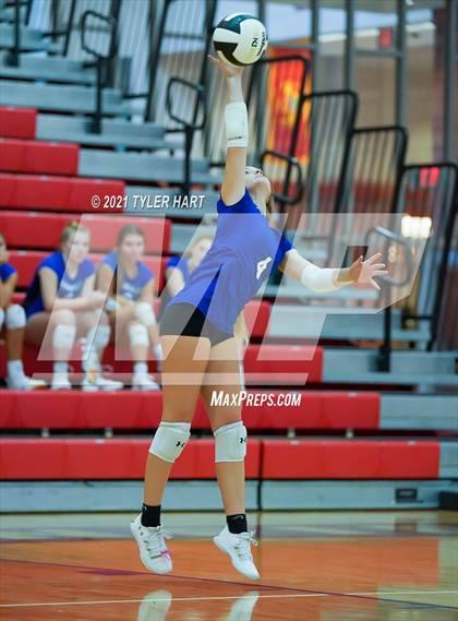 Thumbnail 3 in JV: Franklin Community @ Plainfield photogallery.