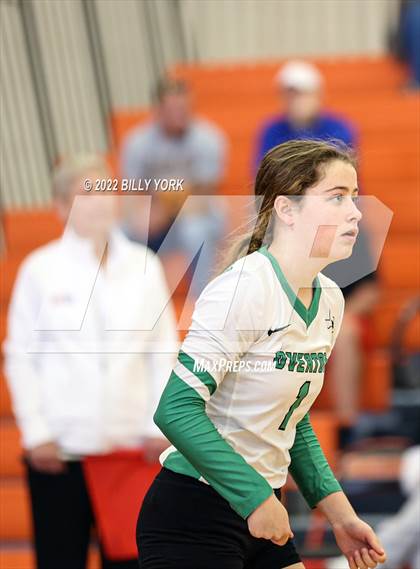 Thumbnail 1 in Overton vs Detroit photogallery.