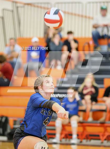 Thumbnail 1 in Overton vs Detroit photogallery.