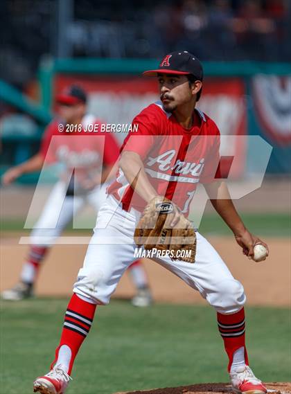 Thumbnail 1 in Liberty vs. Arvin (CIF CS D5 Final) photogallery.