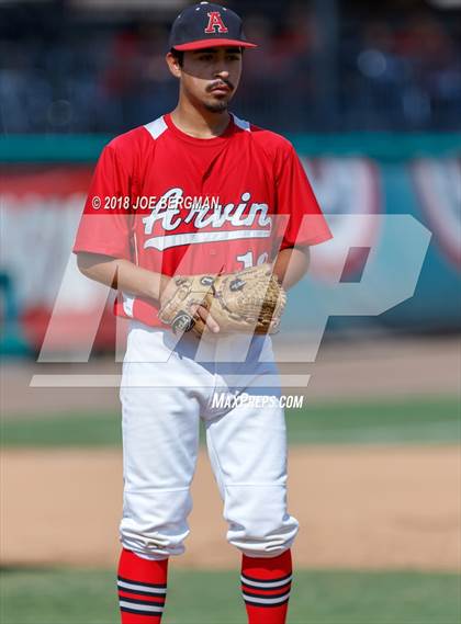 Thumbnail 3 in Liberty vs. Arvin (CIF CS D5 Final) photogallery.