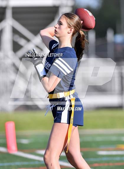 Thumbnail 3 in Timber Creek Regional @ Washington Township photogallery.