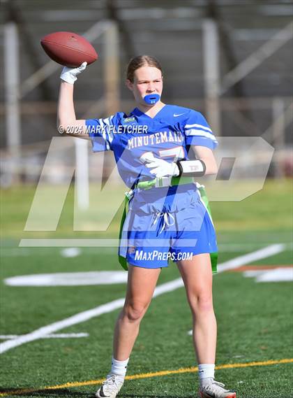 Thumbnail 2 in Timber Creek Regional @ Washington Township photogallery.