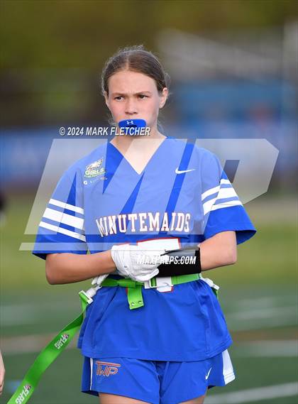 Thumbnail 3 in Timber Creek Regional @ Washington Township photogallery.