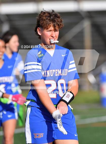 Thumbnail 3 in Timber Creek Regional @ Washington Township photogallery.