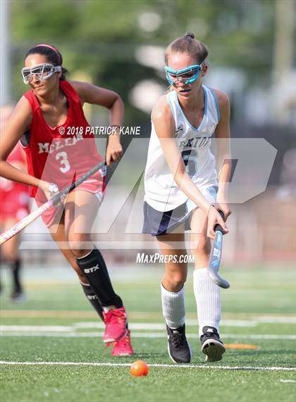 Thumbnail 3 in McLean @ Yorktown photogallery.