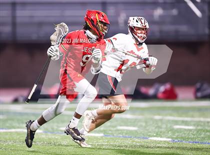 Thumbnail 2 in Jesuit @ Monte Vista (CIFNCS D1 Rd1) photogallery.