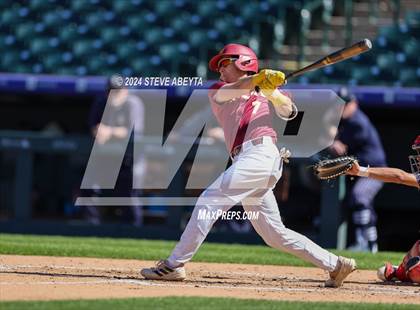 Thumbnail 1 in Severance vs Rocky Mountain (Coors Field) photogallery.