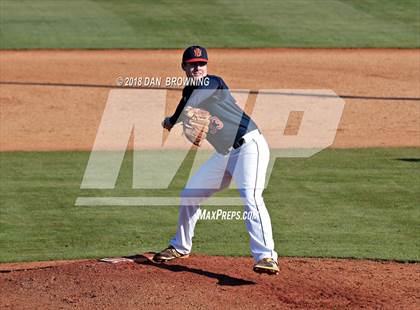 Thumbnail 3 in Carter vs William Blount (Play For A Cure Tournament) photogallery.