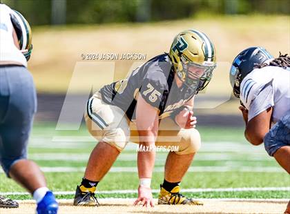 Thumbnail 2 in Overhills @ Pinecrest photogallery.