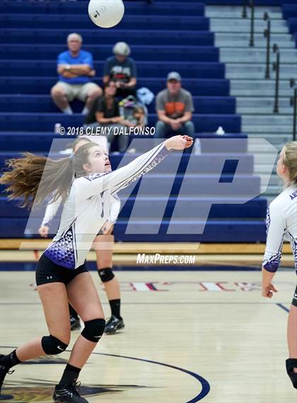 Thumbnail 1 in Arvada West @ Dakota Ridge photogallery.