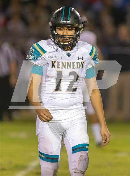 Thumbnail 1 in Kennedy vs. Shafter (CIF CS D5 Final) photogallery.