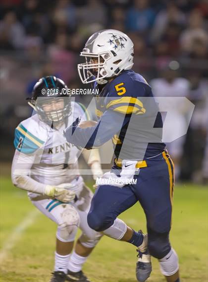 Thumbnail 2 in Kennedy vs. Shafter (CIF CS D5 Final) photogallery.