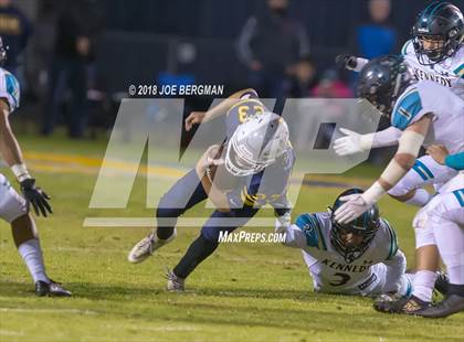 Thumbnail 1 in Kennedy vs. Shafter (CIF CS D5 Final) photogallery.