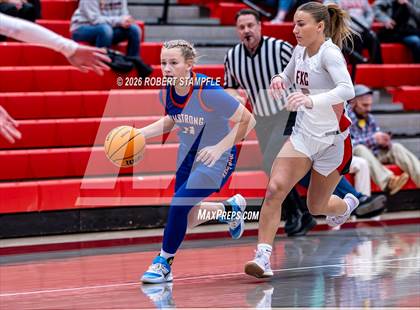 Thumbnail 2 in Armstrong @ Fox Chapel photogallery.