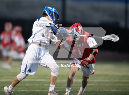 Thumbnail 2 in Fairview @ Highlands Ranch photogallery.