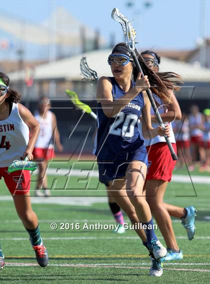 Thumbnail 1 in Northwood @ Tustin photogallery.