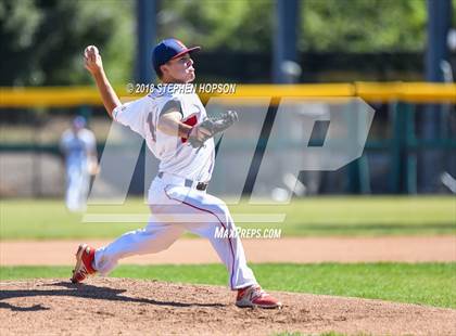 Thumbnail 3 in Beyer vs. Christian Brothers (CIF SJS D3 Final) photogallery.