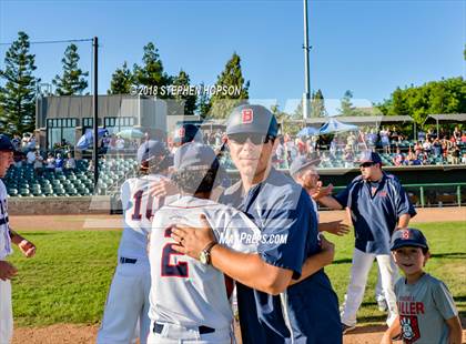 Thumbnail 3 in Beyer vs. Christian Brothers (CIF SJS D3 Final) photogallery.