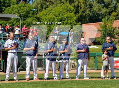 Thumbnail 3 in Beyer vs. Christian Brothers (CIF SJS D3 Final) photogallery.