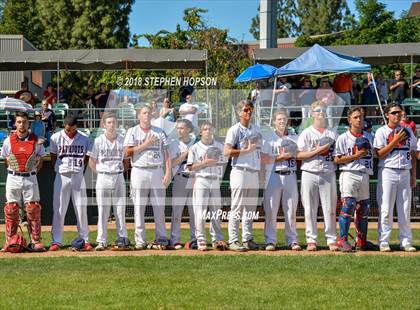 Thumbnail 1 in Beyer vs. Christian Brothers (CIF SJS D3 Final) photogallery.