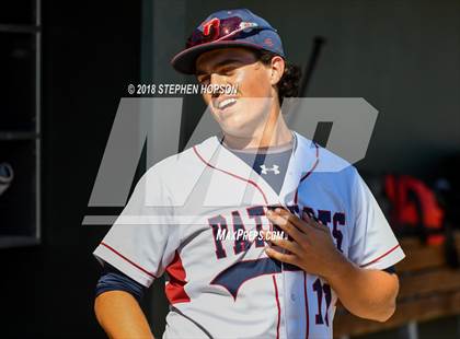 Thumbnail 2 in Beyer vs. Christian Brothers (CIF SJS D3 Final) photogallery.