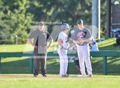 Thumbnail 1 in Beyer vs. Christian Brothers (CIF SJS D3 Final) photogallery.