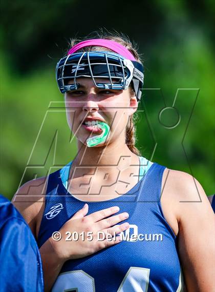 Thumbnail 1 in Alonso @ Newsome photogallery.