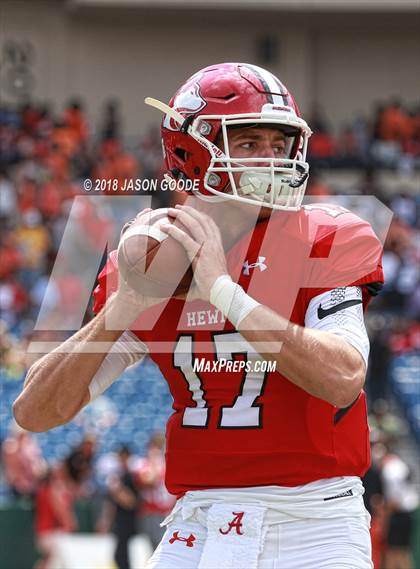 Thumbnail 1 in Cedar Grove vs. Hewitt-Trussville photogallery.
