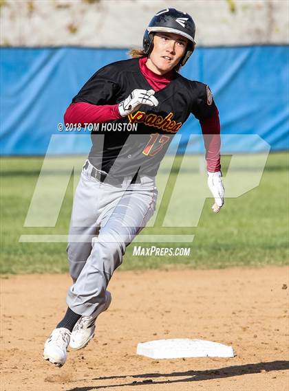 Thumbnail 1 in Los Altos vs Arcadia photogallery.