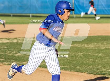 Thumbnail 2 in Los Altos vs Arcadia photogallery.