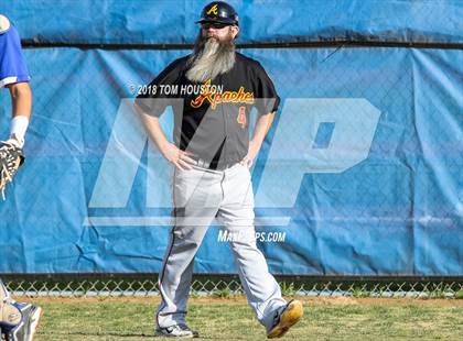 Thumbnail 2 in Los Altos vs Arcadia photogallery.
