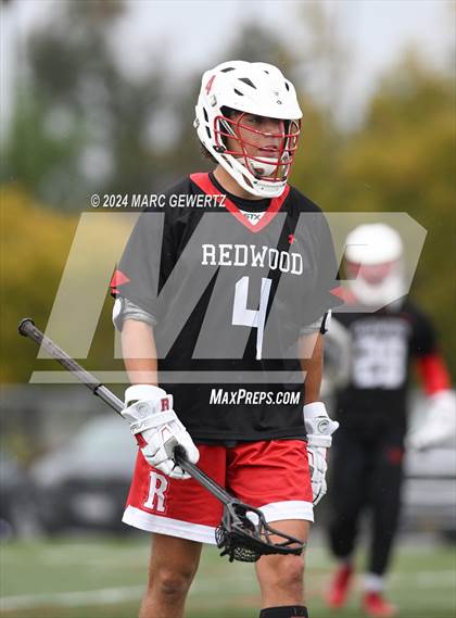 Thumbnail 3 in Redwood @ Foothill photogallery.