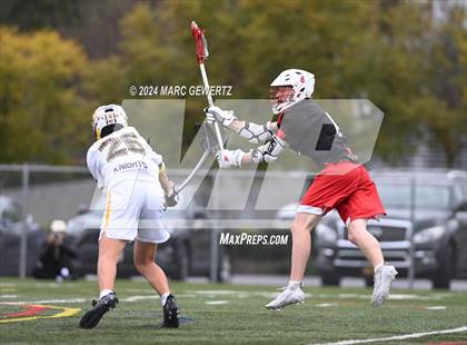 Thumbnail 3 in Redwood @ Foothill photogallery.