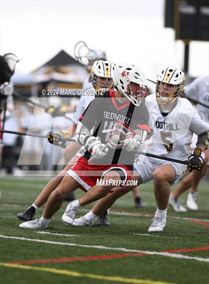Thumbnail 3 in Redwood @ Foothill photogallery.