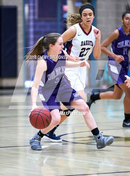 Thumbnail 3 in Arvada West @ Dakota Ridge photogallery.