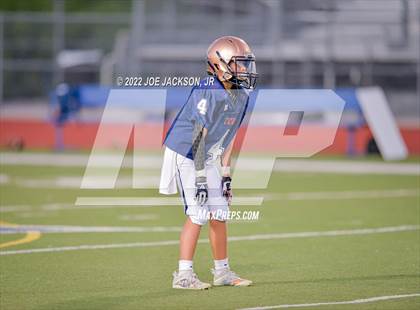 Thumbnail 1 in FR: Cienega vs Millennium photogallery.