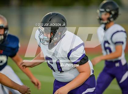 Thumbnail 3 in FR: Cienega vs Millennium photogallery.