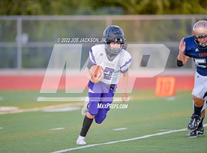Thumbnail 3 in FR: Cienega vs Millennium photogallery.