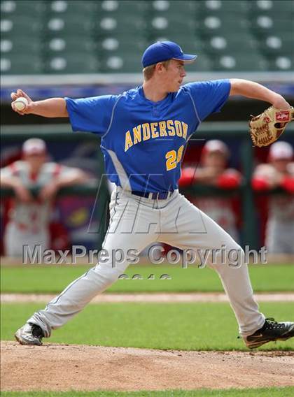 Thumbnail 2 in Anderson vs. Belton (Rock Hardball Classic) photogallery.