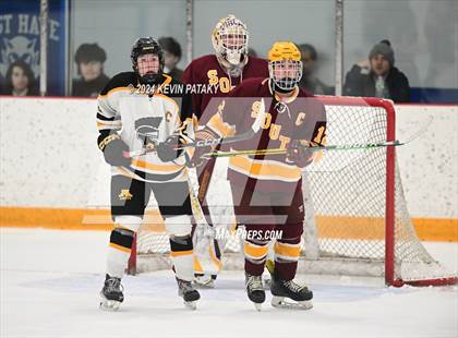 Thumbnail 2 in South Windsor @ Amity Regional (DII 1st Round) photogallery.